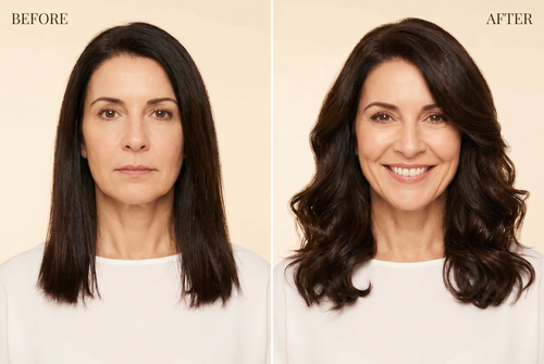 Before and after